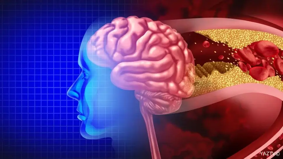 İnsult keçirdi, telefona çatmaq üçün iki saat süründü